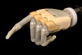 Handprothese von Touch Bionic