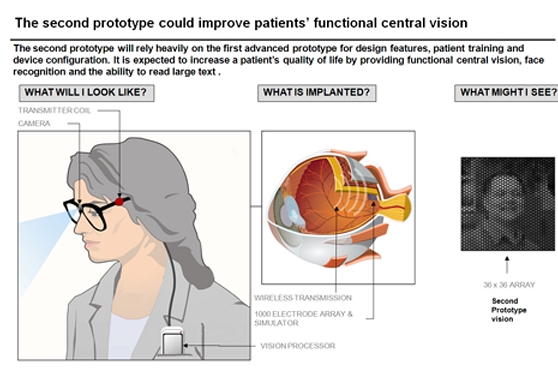 Der Nachfolger soll leistungsfähiger werden. (Grafik: Bionic Vision Australia)