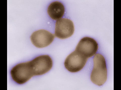 Mycoplasma mycoides JCVI-syn1.0 (Foto: JCVI)