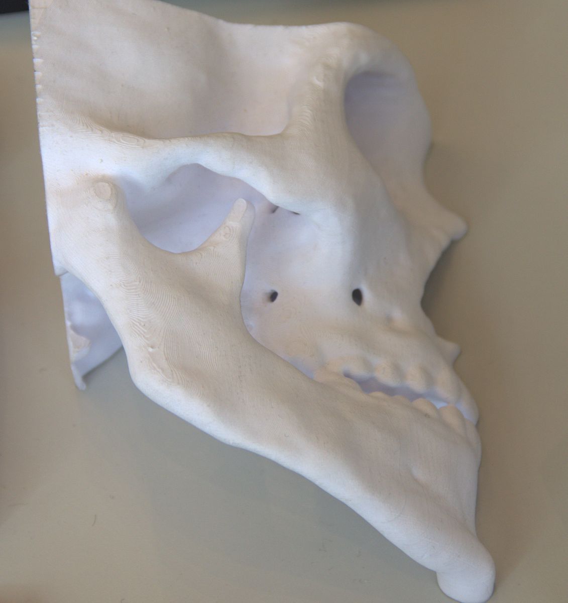 Auch für medizinische Anwendungen lässt sich der 3D-Drucker nutzen. (Foto: wp)
