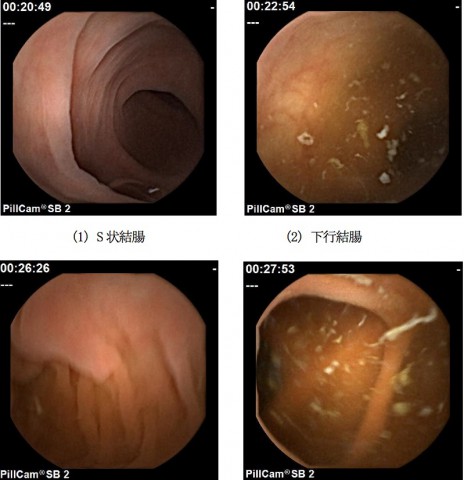 Bilder der Kapselendoskop-Kamera (Bild: Osaka Medical College)
