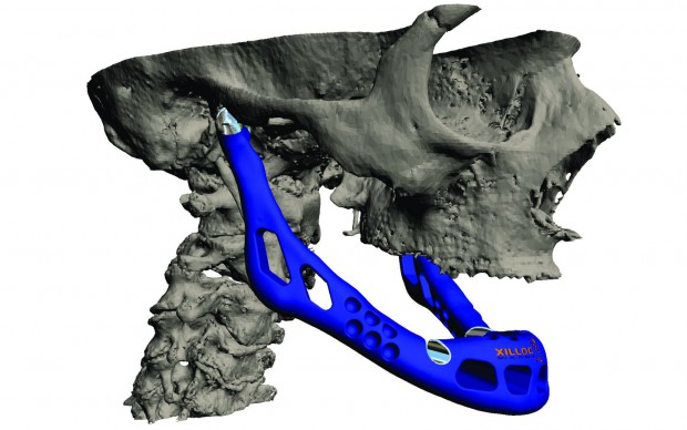 ... und von der Seite (Bild: Layerwise)
