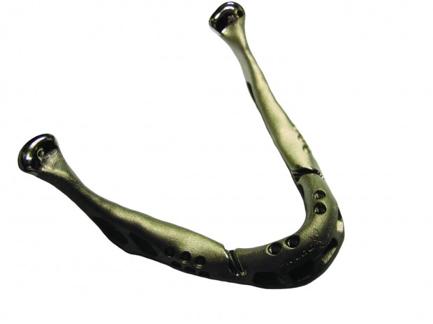 Das Implantat wurde aus Titanpulver aufgebaut... (Bild: Layerwise)