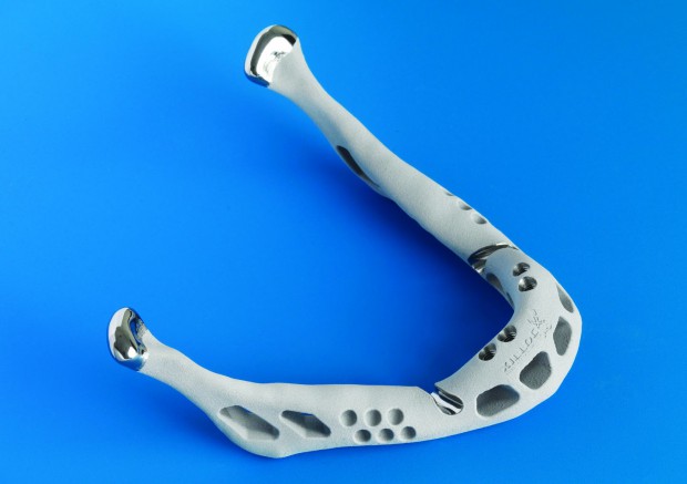 ... und anschließend mit einer Biokeramik beschichtet. (Bild: Layerwise)