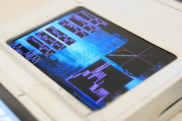 Das Display des Mark 2