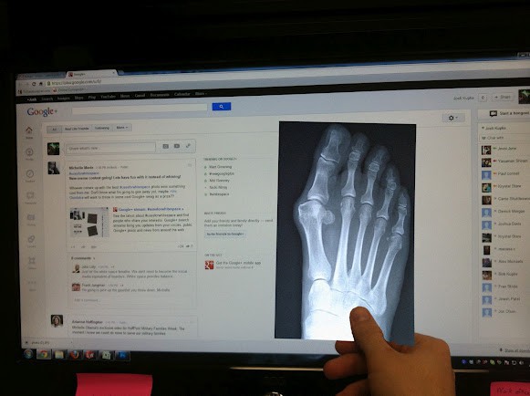 Josh Kupke betrachtet damit Röntgenbilder. (Foto: Josh Kupke)