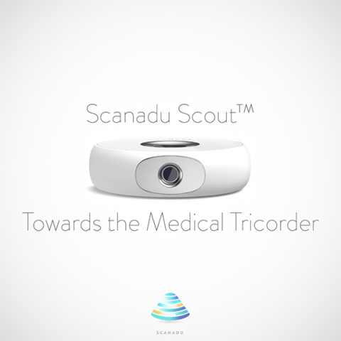 Scanadu Scout (Bild: Indiegogo)