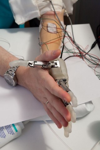 Das sensorische Feedback ermöglichten... (Foto: Lifehand2Project/Universität Freiburg)