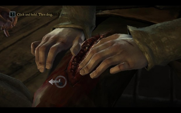 Auch ein paar Ekelszenen wie diese Not-OP sind im Angebot. (Screenshot: Golem.de)