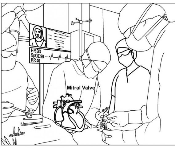 Patent-Grafiken (Bild: Magic Leap)