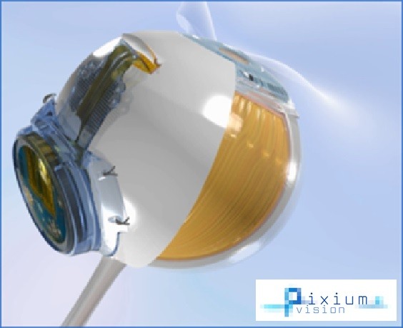 Implantat  (Bild: Pixium Vision)